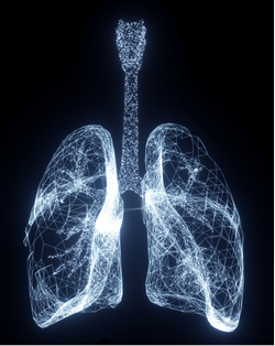 X-ray image of lungs full of air.